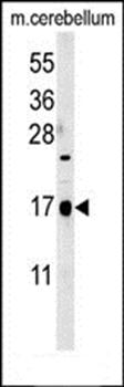 CA095 antibody