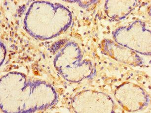 CA11 Antibody