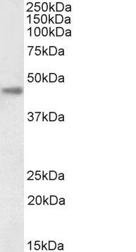 CA12 antibody (Biotin)
