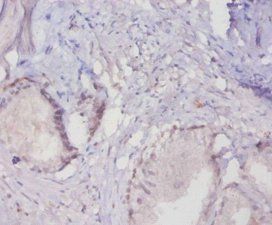 MUC16 Antibody