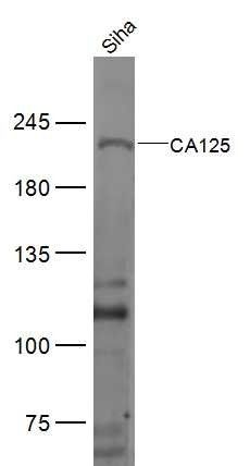 CA125 antibody