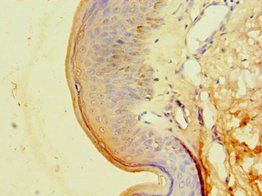 CA14 antibody