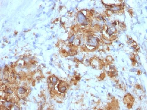 CA19-9/Sialyl Lewisa (GI Tumor Marker) Antibody