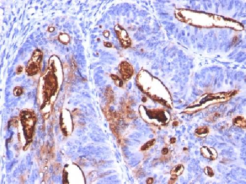CA19-9/Sialyl Lewisa (GI Tumor Marker) Antibody