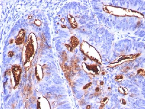 CA19-9 antibody