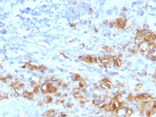Recombinant CA19-9/Sialyl Lewisa (GI Tumor Marker) Antibody