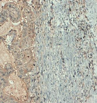 CA19-9 Monoclonal Antibody [121SLE]