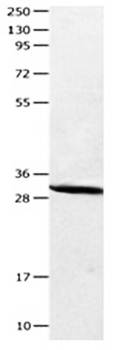 CA2 Antibody