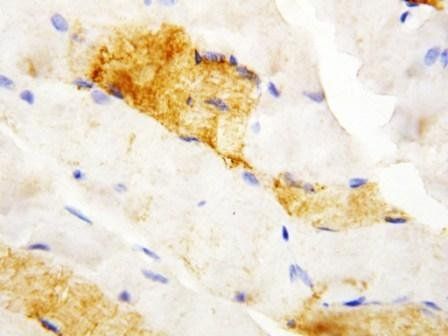 Anti-Carbonic Anhydrase III/CA3 Antibody