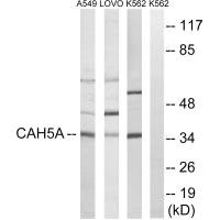 CA5A antibody