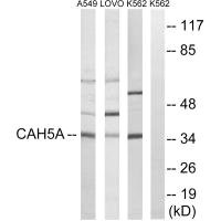 CA5A Antibody