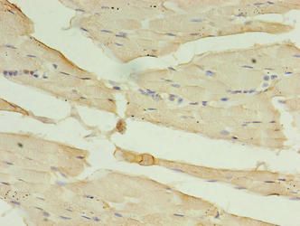 CA5B Antibody