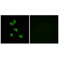 CA5B Antibody