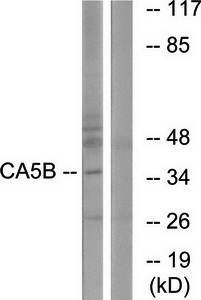 CA5B Antibody