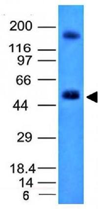 CA9 antibody