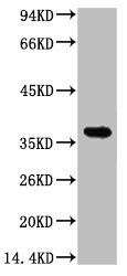 CA9 antibody