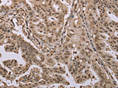 CAB39 Antibody