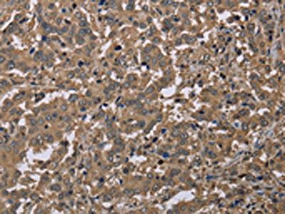 CAB39 Antibody