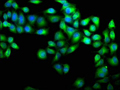 CAB39 antibody