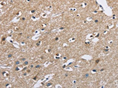 CAB39L Antibody