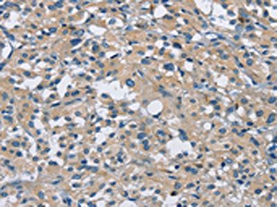 CAB39L Antibody