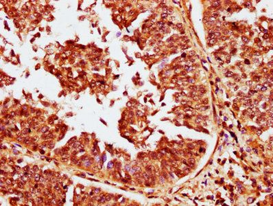 CABIN1 Antibody