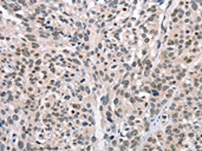 CABLES1 Antibody