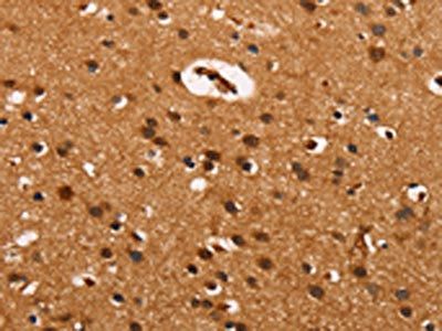 CABLES2 Antibody