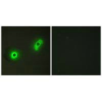 CABLES2 Antibody