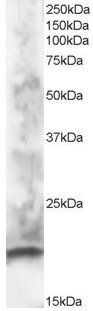 CABP1 antibody