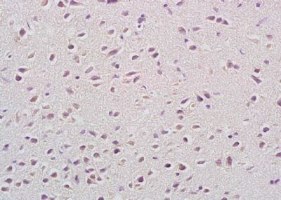 CACH3 Rabbit Polyclonal Antibody