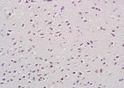 CACH3 antibody