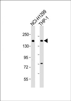 CACNA1A antibody