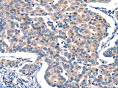 CACNA1A Antibody