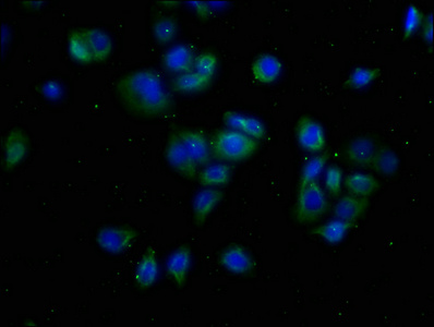 CACNA1A Antibody