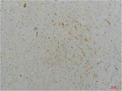 CACNA1B Antibody