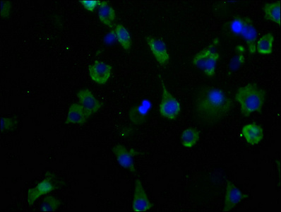 CACNA1B Antibody