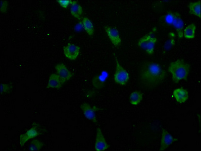 CACNA1B antibody