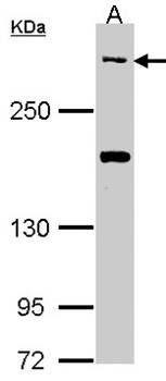 CACNA1B antibody