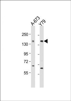CACNA1F antibody