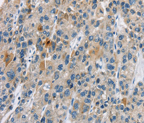 CACNA2D1 Antibody