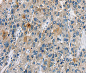 CACNA2D1 antibody