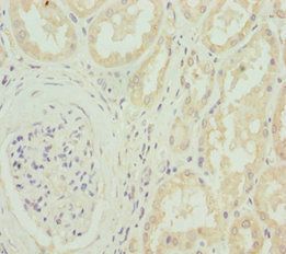 CACNB1 Antibody