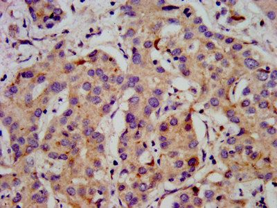 CACNB2 Antibody