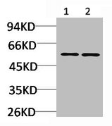 CACNB3 Antibody
