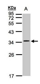 voltage-dependent calcium channel gamma-5 subunit isoform b antibody