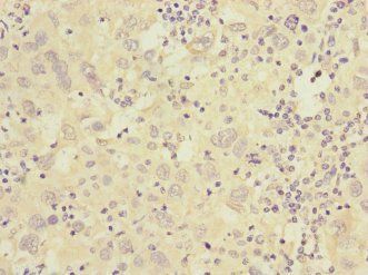 CACNG7 Antibody
