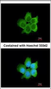CacyBP antibody [N1C3]