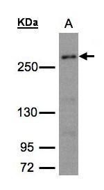 CAD Rabbit Polyclonal Antibody