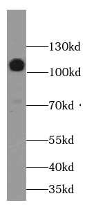 Cadherin-13 antibody